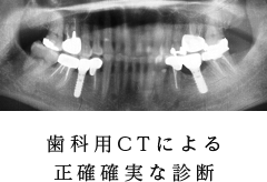 歯科用CT完備による正確確実な診断